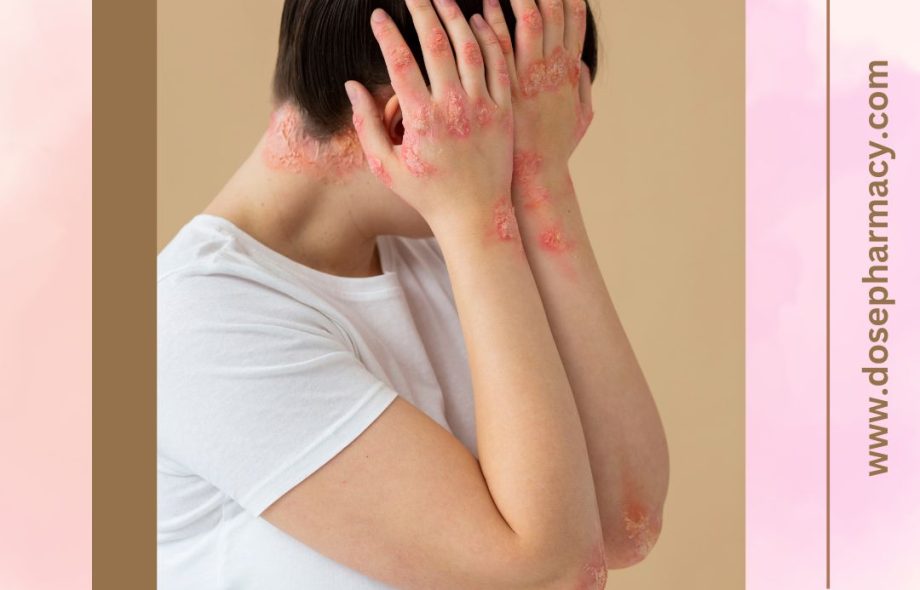 Azithromycin for Skin Infections: Is It Effective?