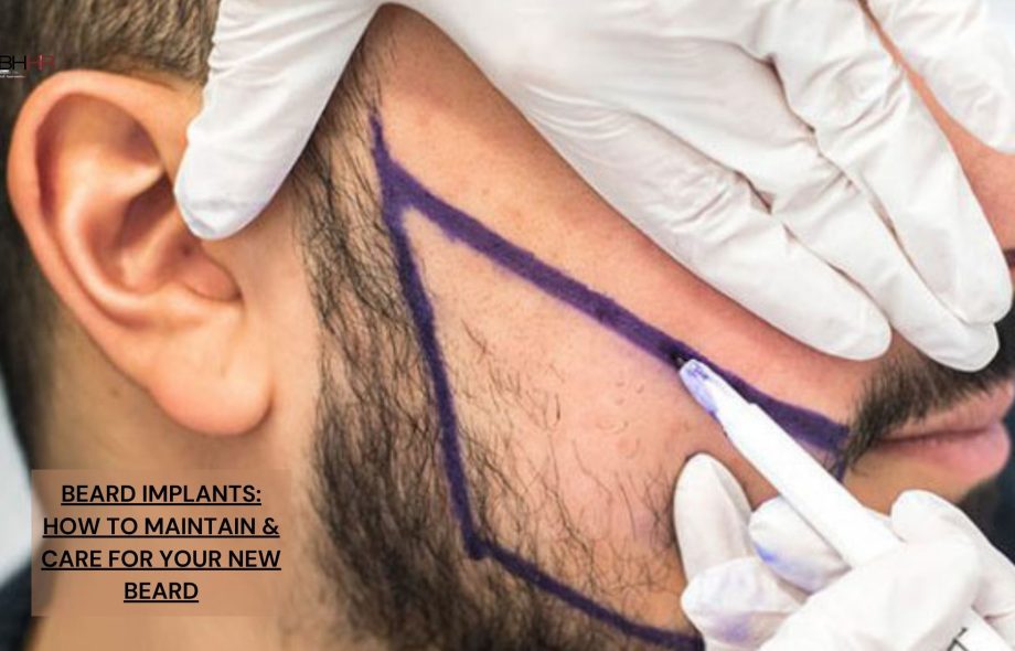 beard implants