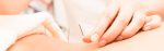 acupuncture