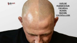 hairline pigmentation