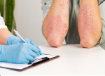 Ivermectin for Humans