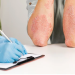 Ivermectin for Humans