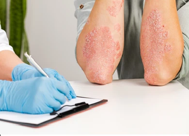 Ivermectin for Humans