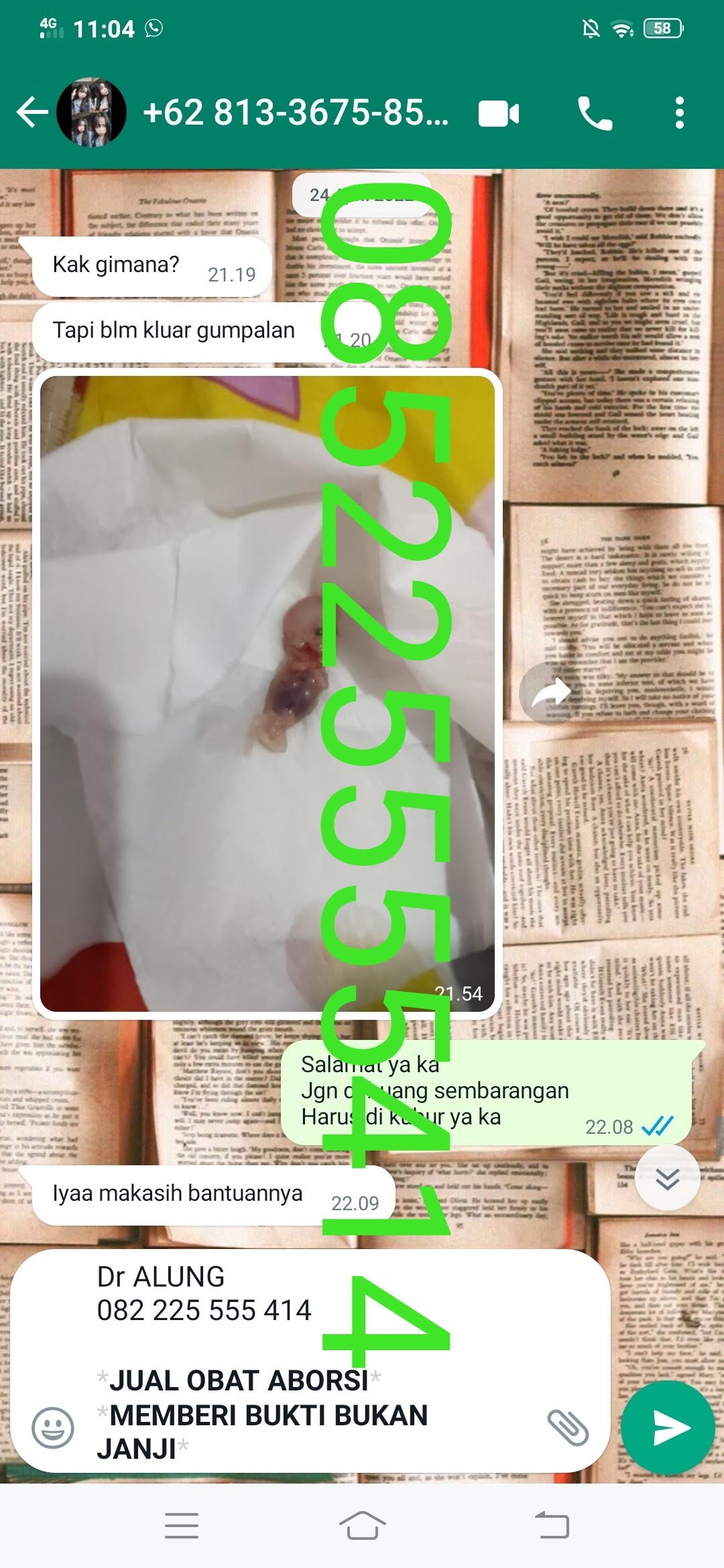 https://wa.me/6285225555414?text=halo%20dr-Alung%20saya%20mau%20order%20obatnya