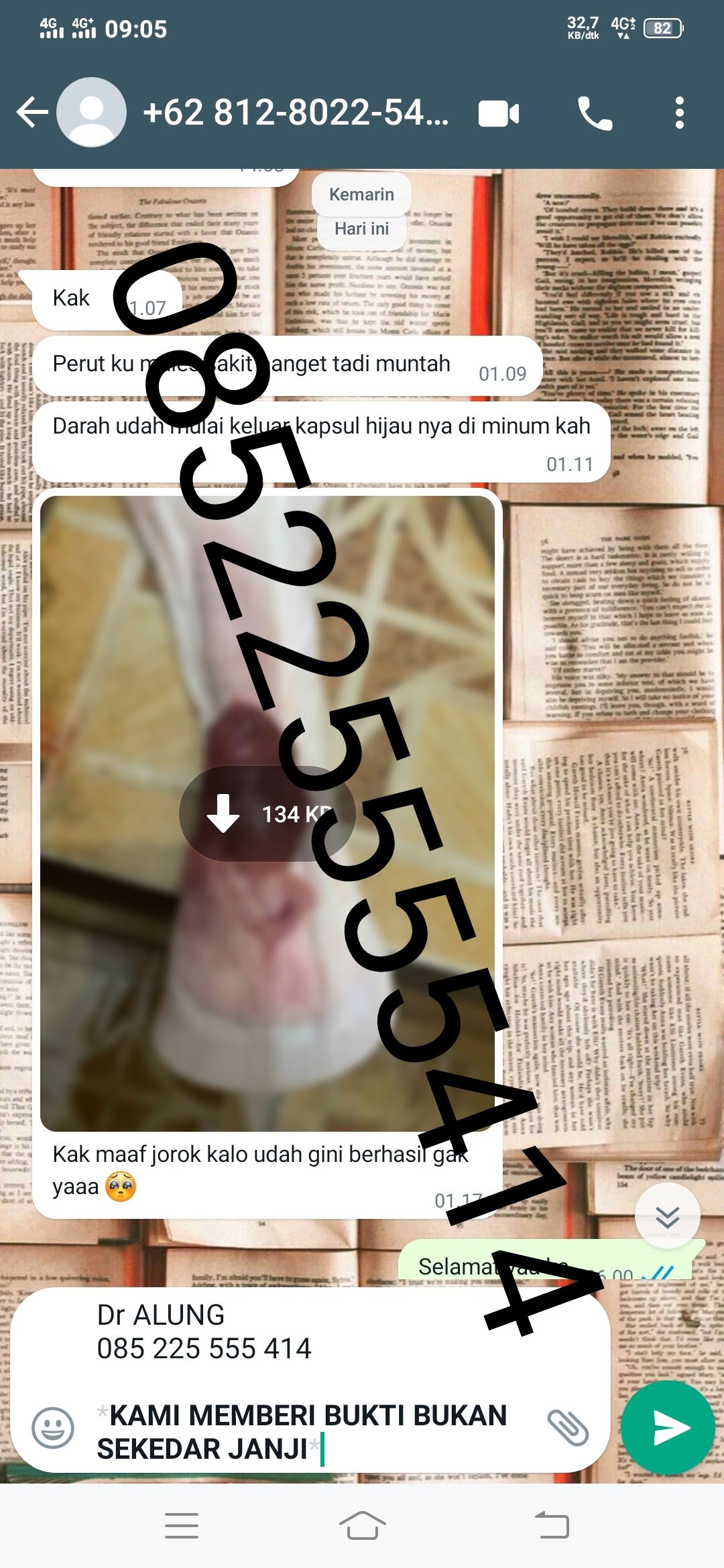 https://wa.me/6285225555414?text=halo%20dr-Alung%20saya%20mau%20order%20obatnya