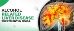 Alcohol Related Liver Disease Treatment In Noida