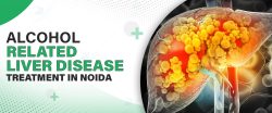 Alcohol Related Liver Disease Treatment In Noida