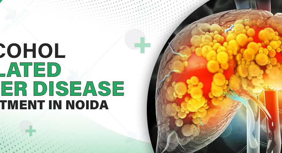 Alcohol Related Liver Disease Treatment In Noida