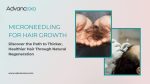 Microneedling-for-Hair-Growth-Advancexo