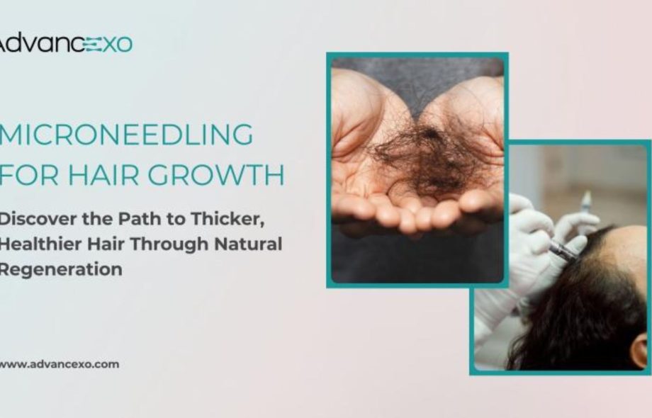 Microneedling-for-Hair-Growth-Advancexo