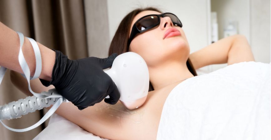 Laser Hair Removal Market