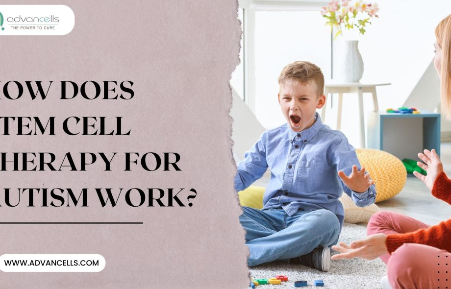 Stem-Cell-Therapy-for-Autism-Advancells