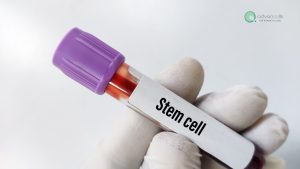 Stem-Cells